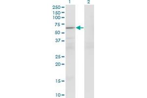 Western Blot analysis of PATZ1 expression in transfected 293T cell line by PATZ1 monoclonal antibody (M01), clone 1B2. (PATZ1 anticorps  (AA 260-358))