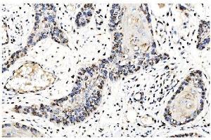 IHC analysis of GOLPH2/GOLM1 using anti-GOLPH2/GOLM1 antibody (ABIN7601505).