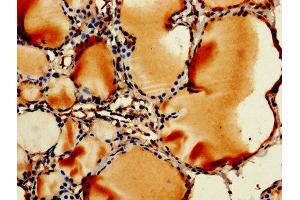 IHC image of ABIN7142736 diluted at 1:250 and staining in paraffin-embedded human thyroid tissue performed on a Leica BondTM system.