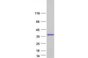 Validation with Western Blot