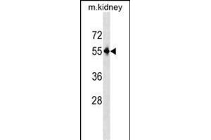 Mouse Pnpla3 Antibody (C-term) (ABIN1537205 and ABIN2850147) western blot analysis in mouse kidney tissue lysates (35 μg/lane). (PNPLA3 anticorps  (C-Term))