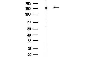 Western blot analysis of lysates from Hela cells(heat-shock,45 min treatment), using Phospho-IRS1 (Ser636) Antibody at 1/1000 dilution.
