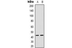 Western blot analysis of MAPKAPK3 expression in Hela (A), Jurkat (B) whole cell lysates. (MAPKAP Kinase 3 anticorps  (C-Term))
