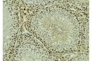 ABIN6269091 at 1/100 staining Mouse testis tissue by IHC-P.
