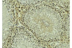 ABIN6269091 at 1/100 staining Mouse testis tissue by IHC-P. (Integrin beta 3 anticorps  (C-Term))