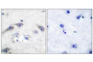 Immunohistochemistry (IHC) image for anti-Protein Phosphatase 1, Regulatory (Inhibitor) Subunit 1B (PPP1R1B) (Thr75) antibody (ABIN1847886) (DARPP32 anticorps  (Thr75))