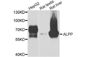 Western blot analysis of extracts of various cell lines, using ALPP antibody. (PLAP anticorps)