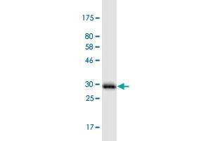 Western Blot detection against Immunogen (31.