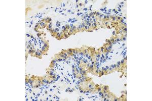 Immunohistochemistry of paraffin-embedded mouse lung using UVRAG antibody at dilution of 1:100 (x40 lens). (UVRAG anticorps)