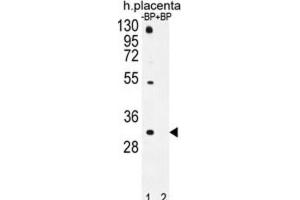 Western Blotting (WB) image for anti-Olfactory Receptor, Family 1, Subfamily D, Member 5 (OR1D5) antibody (ABIN2996487) (OR1D5 anticorps)