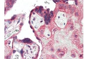 Human Placenta (formalin-fixed, paraffin-embedded) stained with TLR3at 5 µg/ml followed by biotinylated goat anti-rabbit IgG secondary antibody, alkaline phosphatase-streptavidin and chromogen.