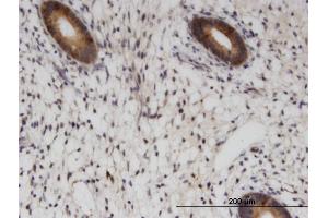 Immunoperoxidase of monoclonal antibody to RAB1B on formalin-fixed paraffin-embedded human endometrium.