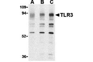 Western Blotting (WB) image for anti-Toll-Like Receptor 3 (TLR3) (N-Term) antibody (ABIN1031621)