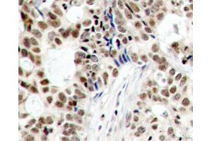 Immunohistochemistry (IHC) image for anti-Breast Cancer 1 (BRCA1) (pSer1423) antibody (ABIN3019881) (BRCA1 anticorps  (pSer1423))