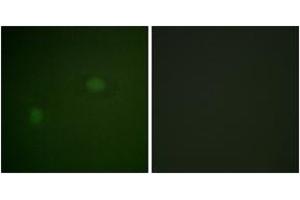 Immunofluorescence analysis of HeLa cells, using NPM (Ab-234) Antibody.