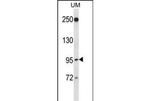 RGL2 Antibody (N-term) (ABIN657382 and ABIN2846427) western blot analysis in uterine tumor cell line lysates (35 μg/lane). (RGL2 anticorps  (N-Term))