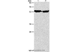 Western blot analysis of Mouse heart and human fetal brain tissue, using ARHGEF9 Polyclonal Antibody at dilution of 1:950 (Arhgef9 anticorps)