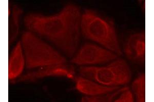 Immunofluorescence staining of methanol-fixed MCF7 cells using p70 S6 Kinase(Phospho-Ser411) Antibody.