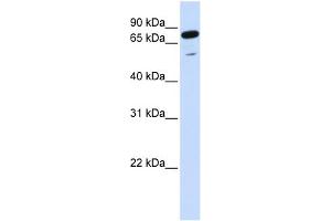 WB Suggested Anti-PPP1R13L Antibody Titration:  0. (PPP1R13L anticorps  (Middle Region))