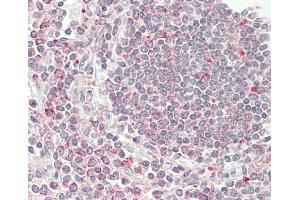 anti-Vesicle-Associated Membrane Protein 8 (Endobrevin) (VAMP8) (AA 1-30), (N-Term) antibody