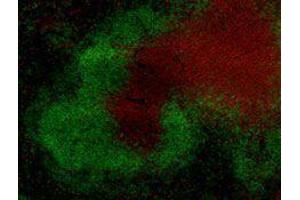 Immunofluorescence (IF) image for anti-T Cell Receptor (TCR) beta (TCR beta) antibody (Alexa Fluor 594) (ABIN2656861) (TCR beta anticorps  (Alexa Fluor 594))