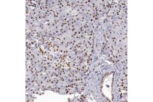 Immunohistochemical staining of human pancreas with TFAP4 polyclonal antibody  shows moderate nuclear positivity in exocrine glandular cells and islet cells. (TFAP4 anticorps)