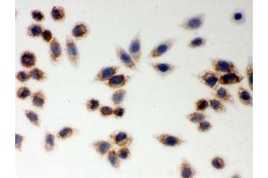 ICC testing of FFPE human SMMC-7721 cells with LYRIC antibody. (MTDH anticorps  (AA 101-270))