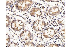 Immunohistochemistry analysis of paraffin-embedded human colon using IL22RA1 Polyclonal Antibody at dilution of 1:200. (IL22 Receptor alpha 1 anticorps)