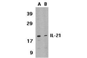 Western Blotting (WB) image for anti-Interleukin 21 (IL21) (Middle Region) antibody (ABIN1030955) (IL-21 anticorps  (Middle Region))