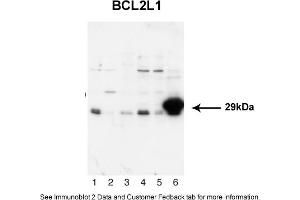 Sample Type: 1. (BCL2L1 anticorps  (N-Term))