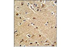 Immunohitochemistry: ZWINT Antibody staining of Formalin-Fixed, Paraffin-Embedded Human Brain Tissue. (ZWINT anticorps  (Middle Region))