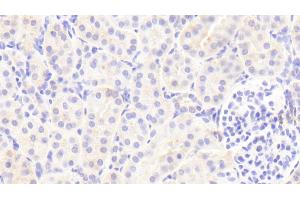 Detection of CFI in Human Kidney Tissue using Polyclonal Antibody to Complement Factor I (CFI)