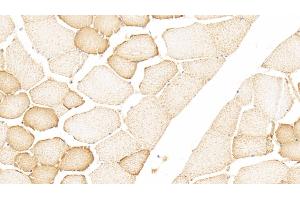Detection of H-FABP in Human Skeletal muscle Tissue using Polyclonal Antibody to Heart-type Fatty Acid Binding Protein (H-FABP)