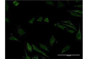 Immunofluorescence of monoclonal antibody to CD40 on HeLa cell. (CD40 anticorps  (AA 21-193))