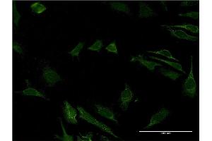 Immunofluorescence of monoclonal antibody to CD40 on HeLa cell.