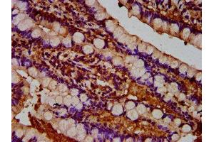 IHC image of ABIN7173930 diluted at 1:300 and staining in paraffin-embedded human small intestine tissue performed on a Leica BondTM system. (TUSC3 anticorps  (AA 42-196))