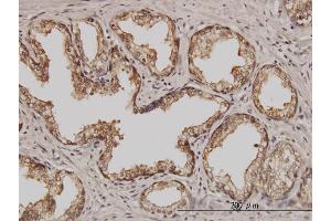 Immunoperoxidase of monoclonal antibody to PSMD5 on formalin-fixed paraffin-embedded human prostate.