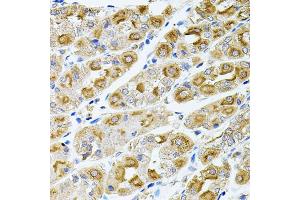 Immunohistochemistry of paraffin-embedded human stomach using MTTP antibody (ABIN5970876) at dilution of 1/100 (40x lens). (MTTP anticorps)