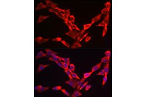 Immunofluorescence analysis of NIH/3T3 cells using WIF1 Rabbit pAb (ABIN6128927, ABIN6150218, ABIN6150220 and ABIN6221033) at dilution of 1:25 (40x lens).
