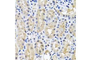 Immunohistochemistry of paraffin-embedded mouse kidney using SNAP29 antibody. (SNAP29 anticorps)