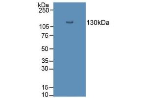 Figure. (Desmoglein 3 anticorps  (AA 858-999))