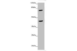 Western blot All lanes: ACSL6 antibody at 4. (ACSL6 anticorps  (AA 458-697))
