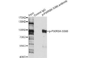 Immunoprecipitation analysis of 200 μg extracts of HeLa cells treated by EGF using 2. (RPS6KA3 anticorps  (pSer380))