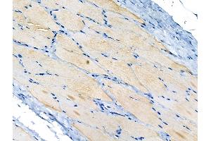 ABIN6264983 and ABIN6266656 at 1/100 staining Rat skin tissue by IHC-P. (SENP1 anticorps  (N-Term))
