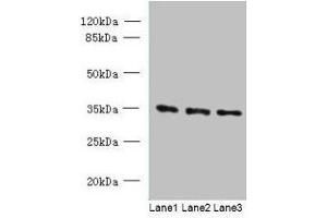 Western blot All lanes: C15orf41 antibody at 1. (BC052040 anticorps  (AA 1-183))