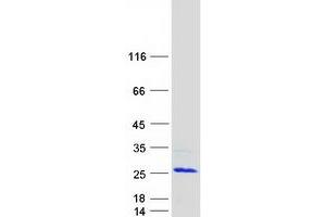 Validation with Western Blot