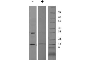 SDS-PAGE of Rat Interferon gamma Recombinant Protein SDS-PAGE Rat Interferon gamma Recombinant Protein. (IFNG1-2 Protéine)