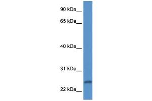 WB Suggested Anti-PI15 Antibody Titration: 1. (PI15 anticorps  (N-Term))