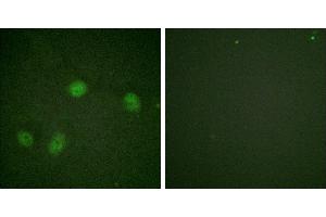 P-peptide - +Immunofluorescence analysis of HeLa cells, using Raf1 (Phospho-Ser621) antibody. (RAF1 anticorps  (pSer621))