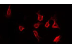 ABIN6266449 staining Hela by IF/ICC. (CCR5 anticorps  (pSer349))